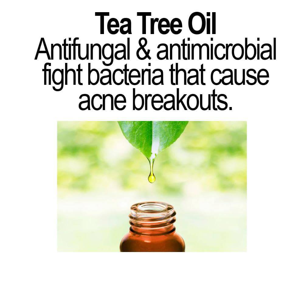 Oil - Regulating Anti - Acne Serum - Trendy Home Mart